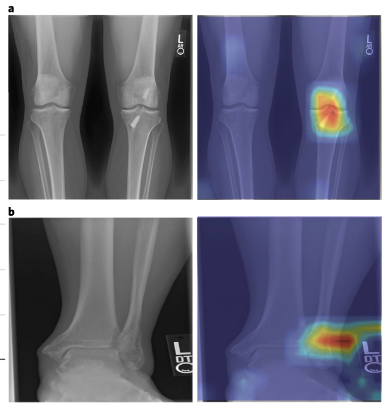 radiographs with highlighted abnormalities